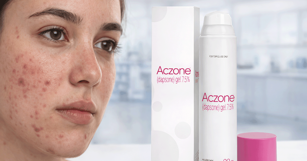How Does Aczone Work for Acne