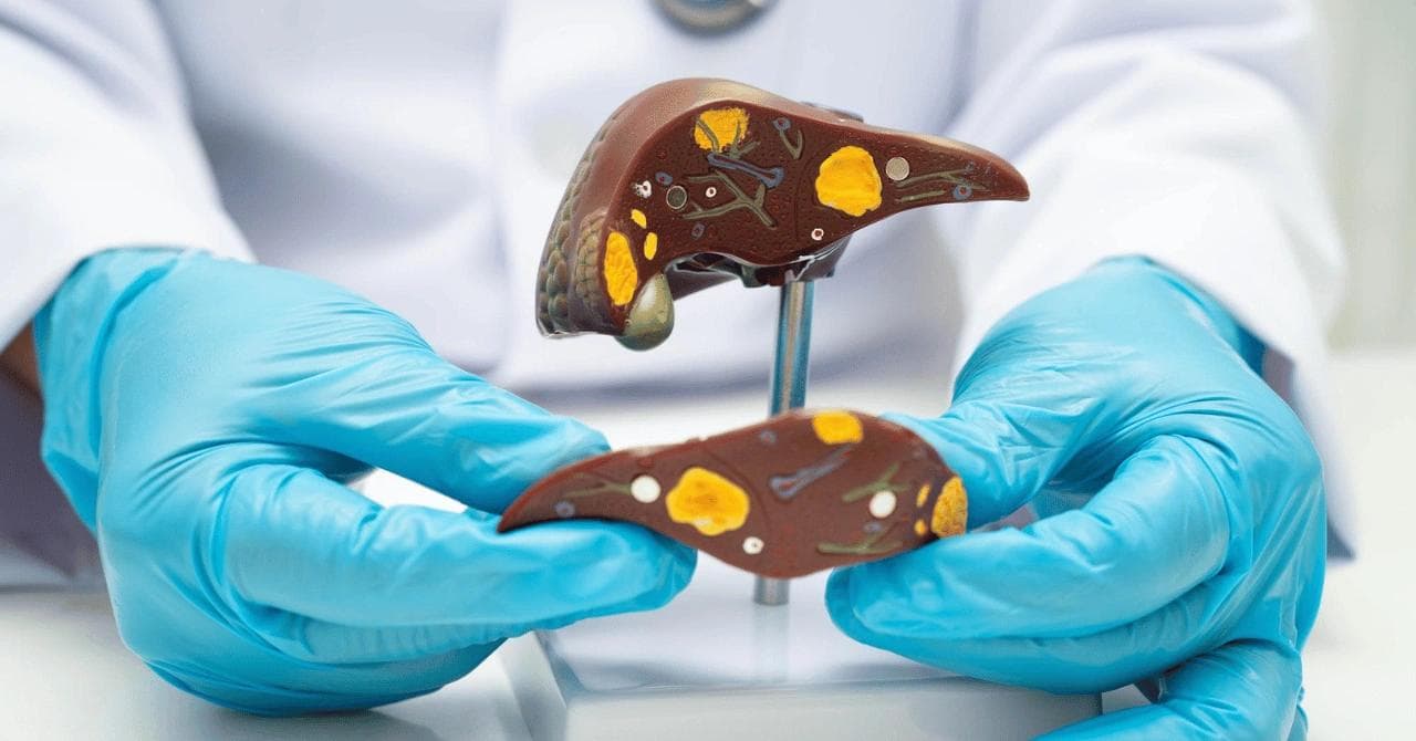 Can You Take Semaglutide or Wegovy Without a Gallbladder