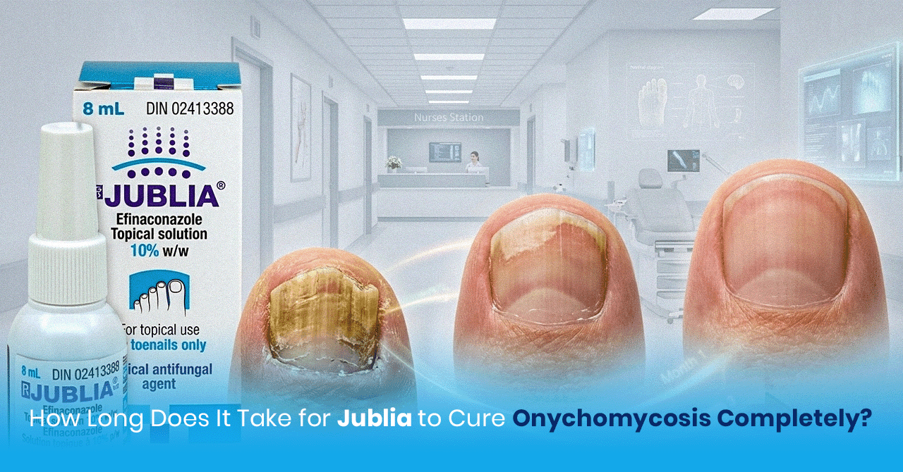 How Long Does It Take for Jublia to Cure Onychomycosis Completely