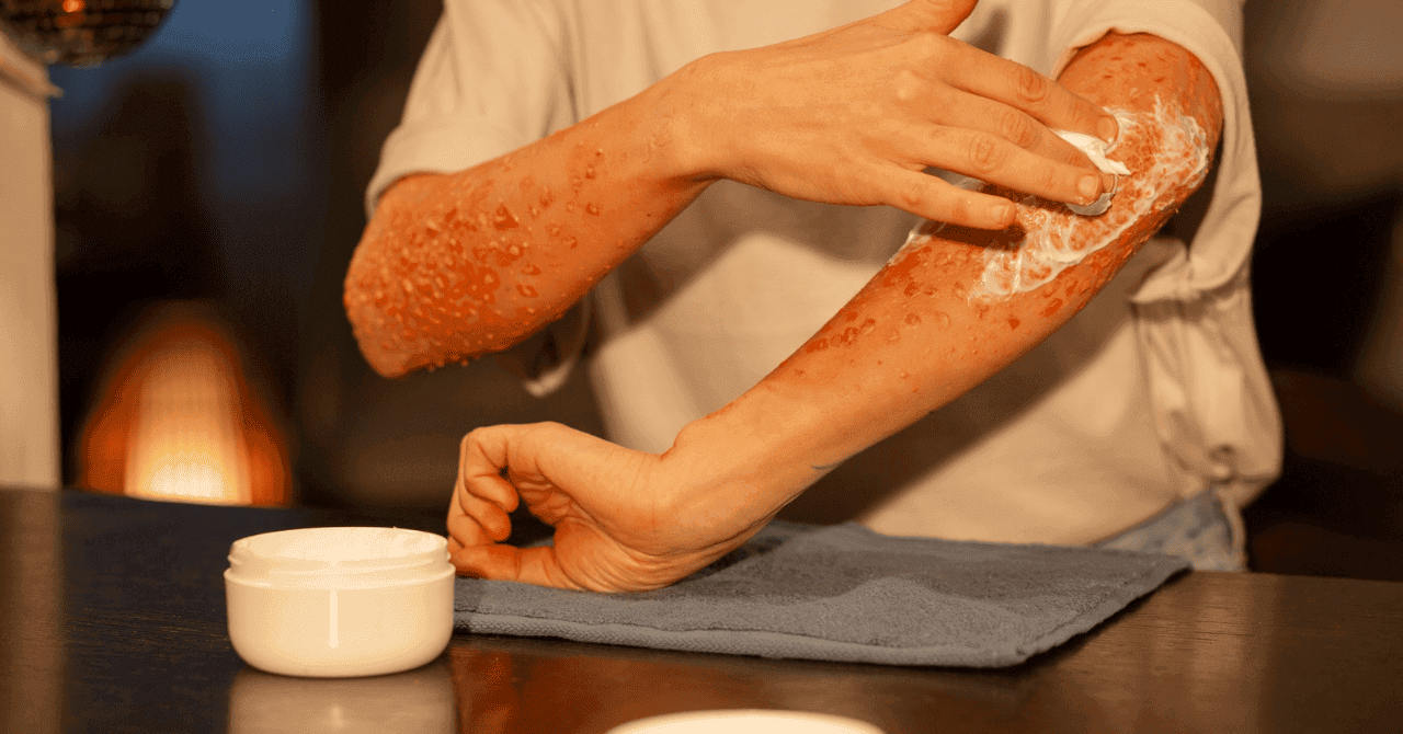 Higher Risk of Allergic Reactions to Zepbound