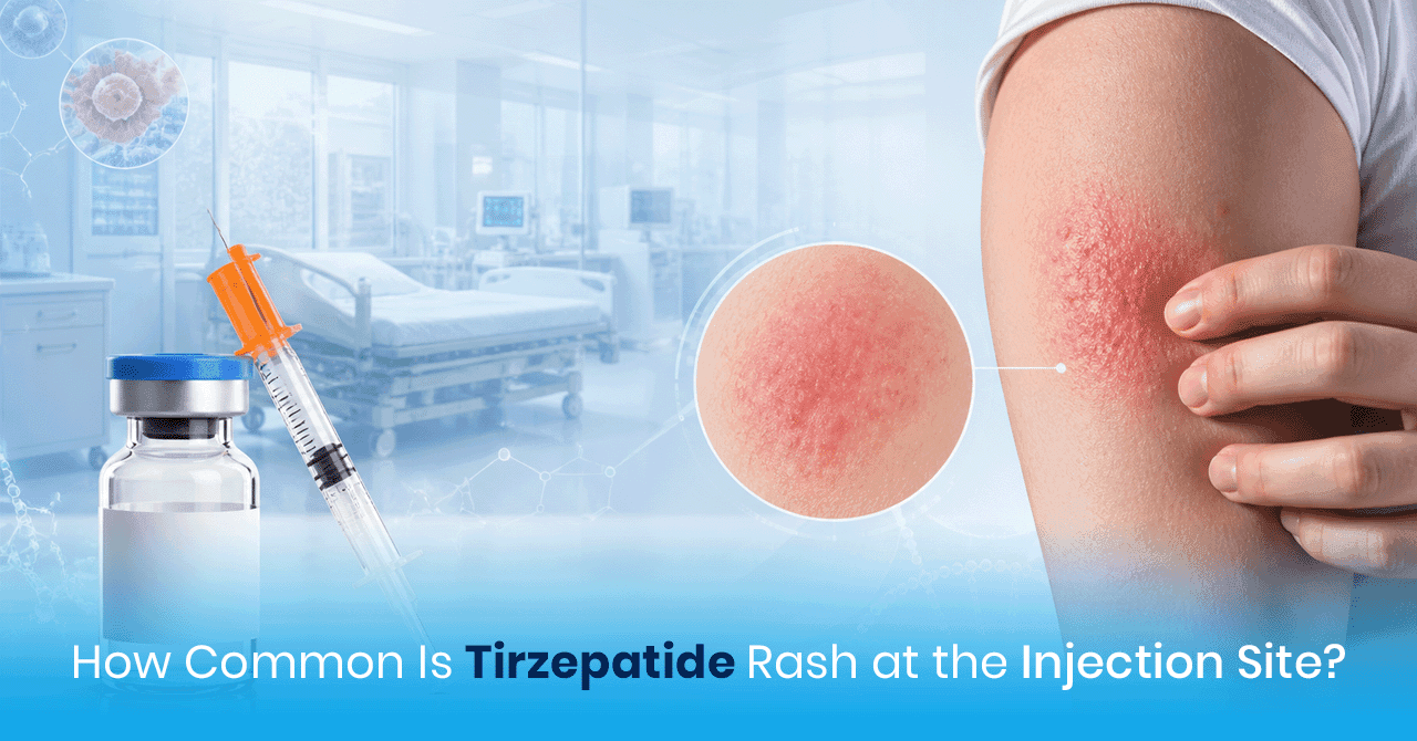 How Common Is Tirzepatide Rash at the Injection