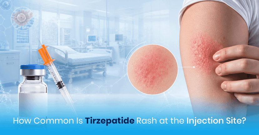 Injection Sight Infection Tirzepatide Rash at Injection Site: Symptoms & Treatment