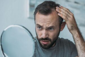 Does Wegovy Cause Hair Loss? Key Insights Revealed