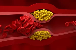 Wegovy for High Cholesterol: How Semaglutide Boosts Your Heart