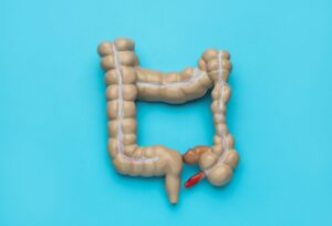 Wegovy and Ulcerative Colitis: Can It Effectively Manage Symptoms?